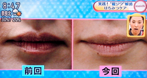 唇の縦じわを改善する方法（NHKあさイチより）